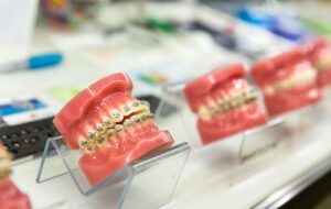 Ortodonta Krapkowice Dentistico